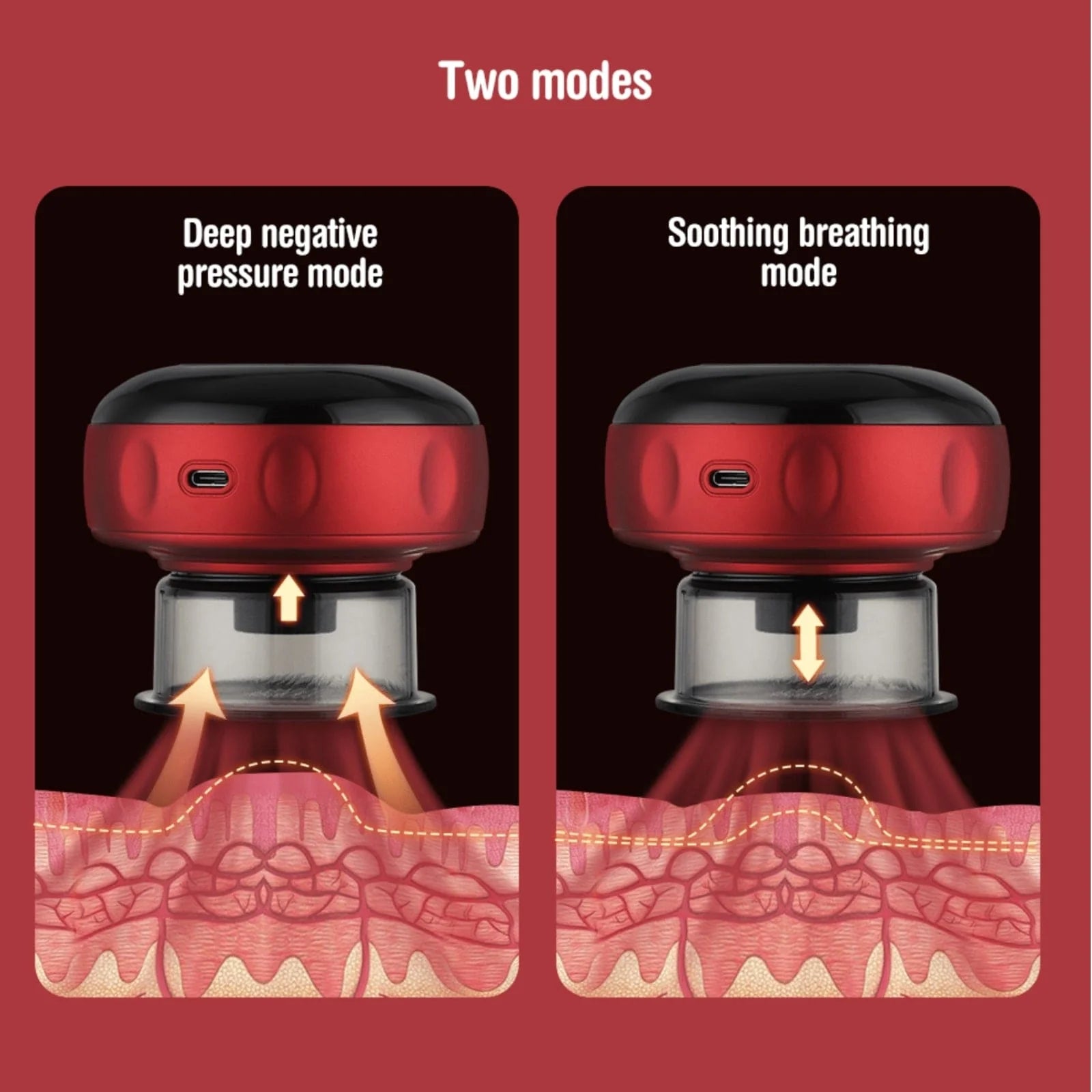 Smart Cupping Therapy Massager: Speed up Your Recovery